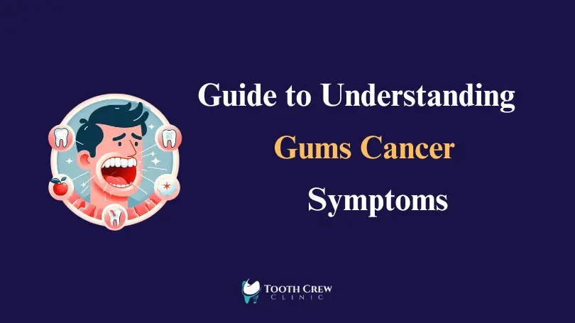 A visual guide illustrating symptoms of gum cancer, providing valuable information for understanding the condition.