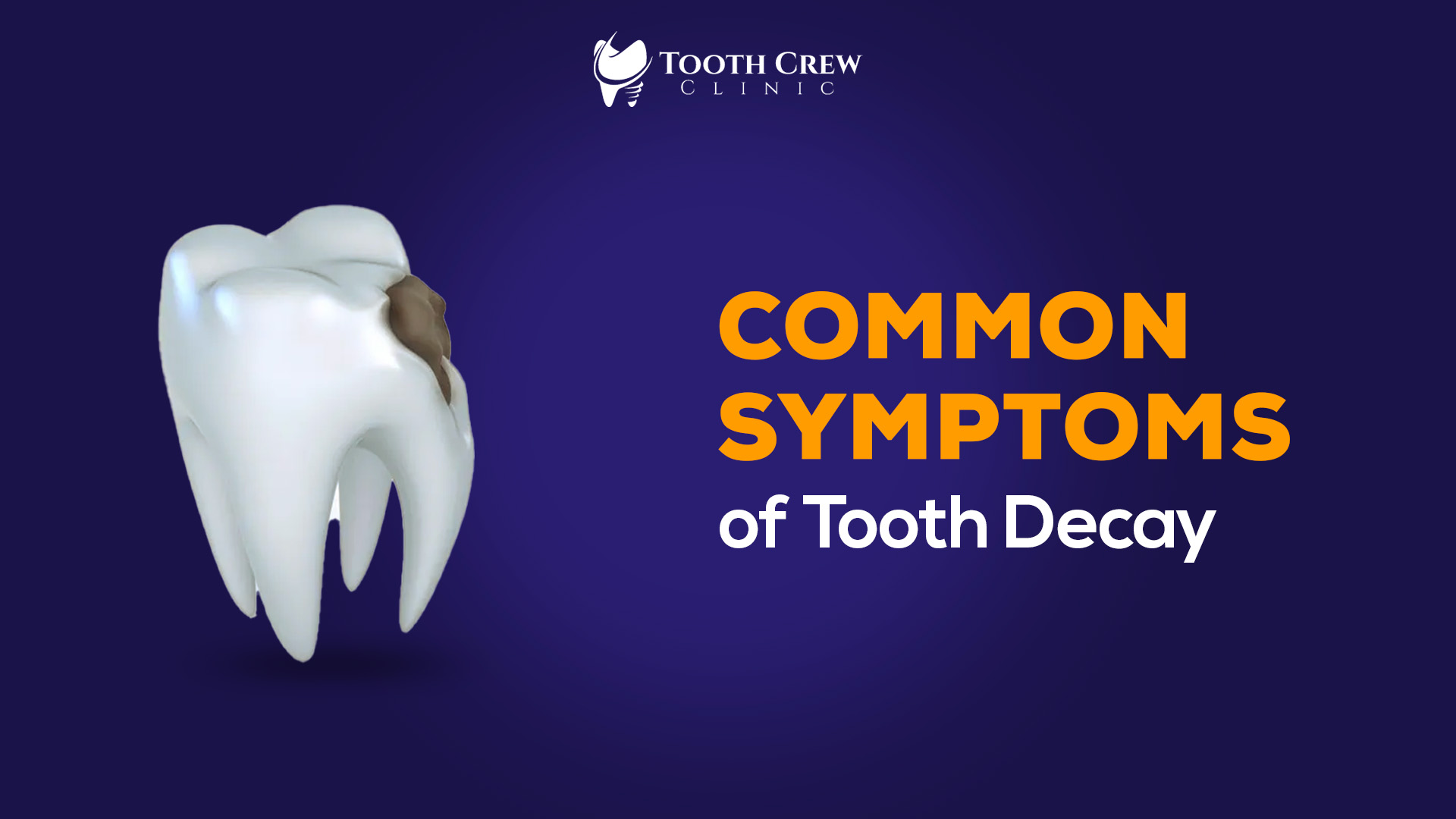 Common Symptoms of Tooth Decay