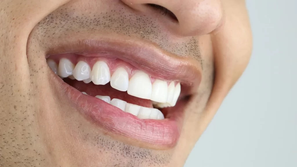 a man with aesthetic smile having beautiful white teeth