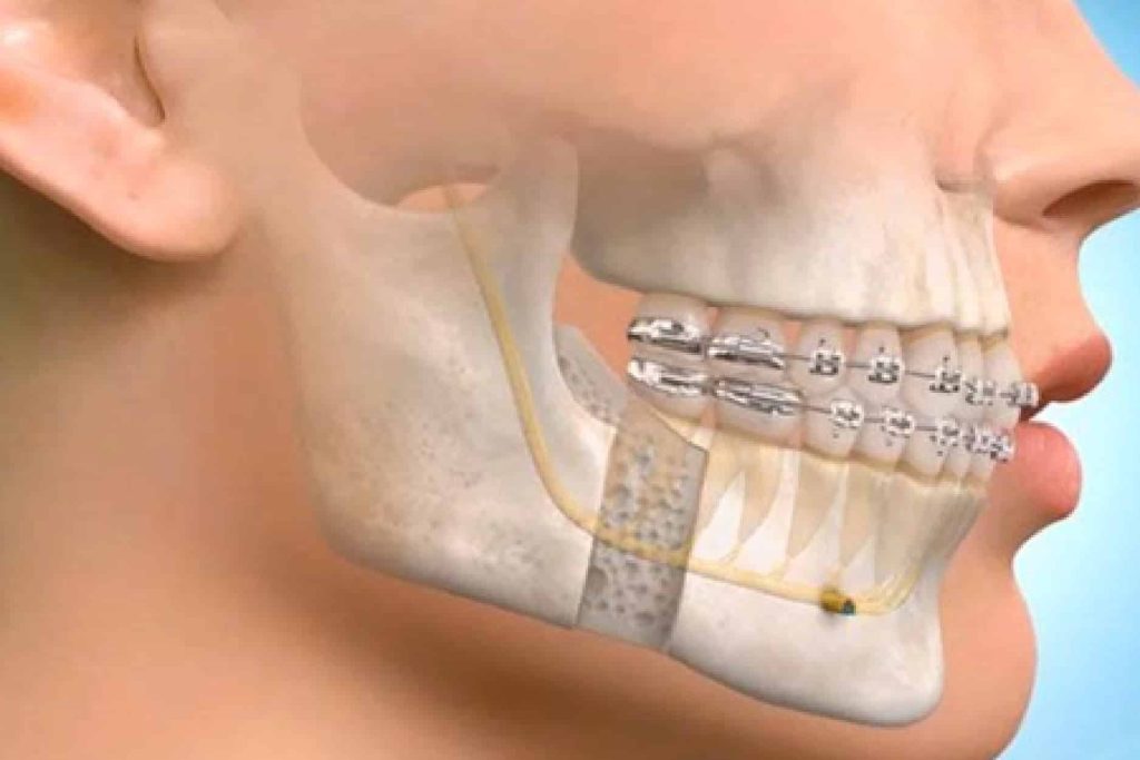 an AI scan of jaw