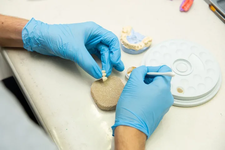 Dental technician shaping a crown on a model in a dental lab