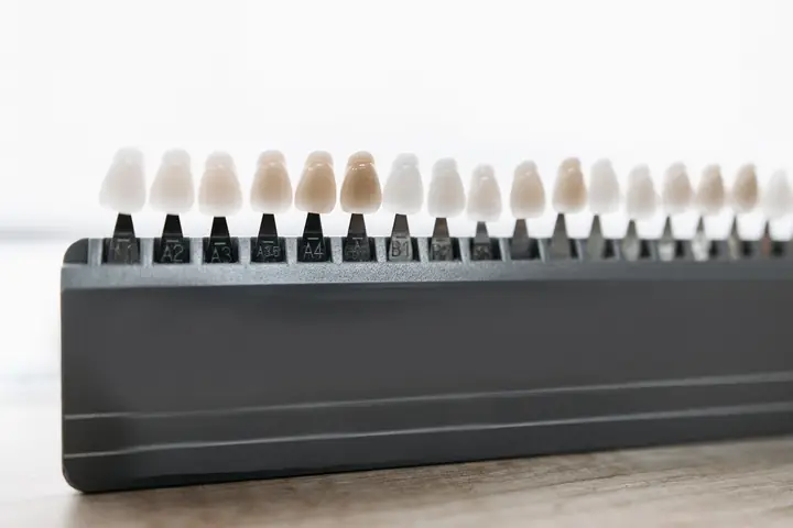 Dental veneer shades lined up for matching to natural teeth